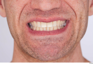 Serban teeth 0001.jpg